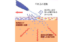 Iontophoresis